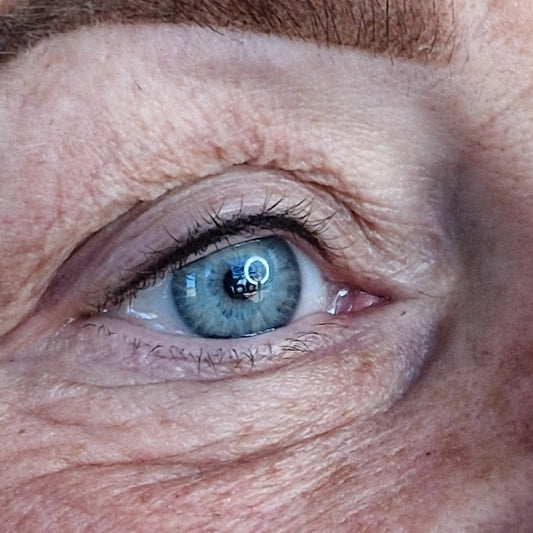 Infralash wimperrand pigmentatie