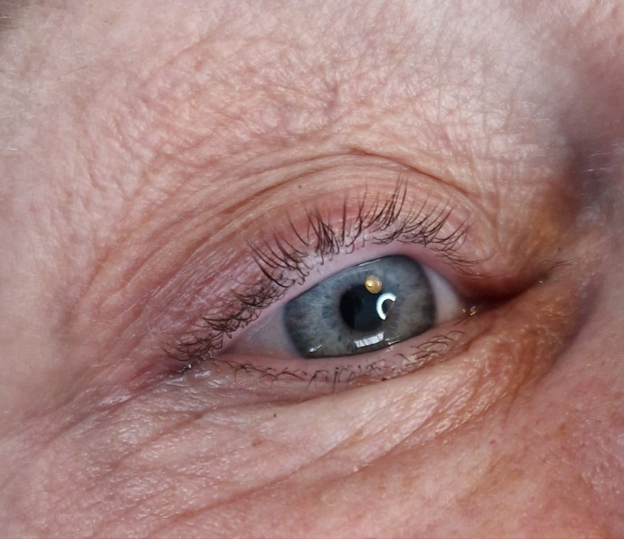 Infralash wimperrand pigmentatie voorfoto